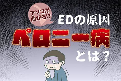 勃起 いたい|【専門医師が解説】ペロニー病：勃起時の曲がりは病。